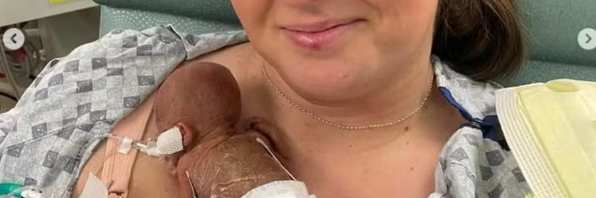 Bebê Prematuro Nash Keen: Um Marco de Esperança e Superação